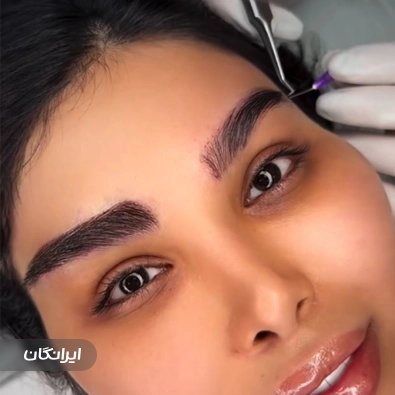 کلینیک کاشت مو ستاره ساعی