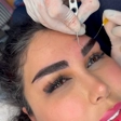 کلینیک کاشت مو ستاره ساعی