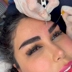 کلینیک کاشت مو ستاره ساعی
