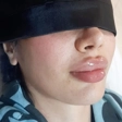 کلینیک زیبایی پرین