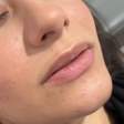 کلینیک زیبایی اکسیر