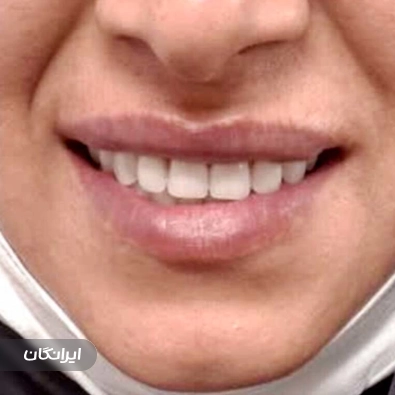 دندانسازی سانترال