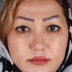 کلینیک کاشت مو زندیه