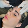 مرکز لیزر و زیبایی ایرانا