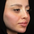 مجموعه پوست و لیزر ماه سیما