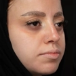 مجموعه پوست و لیزر ماه سیما