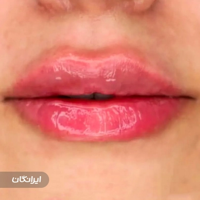 کلینیک زیبایی رویال