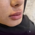 کلینیک زیبایی رویال