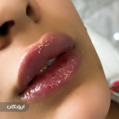 کلینیک زیبایی ایرانا