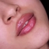 کلینیک زیبایی خورشید غرب