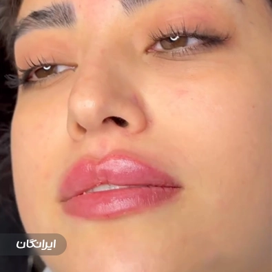 کلینیک زیبایی دکتر محسن پورآریا