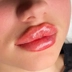 کلینیک زیبایی دکتر لیپ