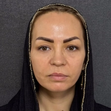 کلینیک زیبایی دکتر فاطمه حسن زاده رستمی
