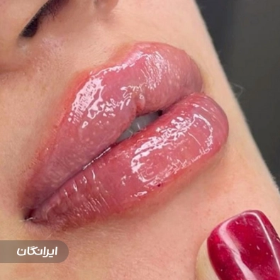 کلینیک زیبایی مرسی
