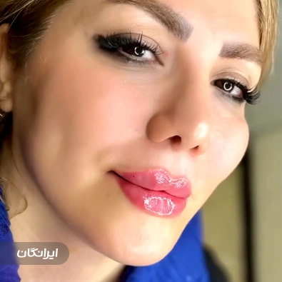 کلینیک زیبایی فرشتگان