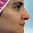 کلینیک زیبایی آپامه