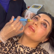 کلینیک زیبایی آتیماه