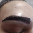 مرکز کاشت مو شیما