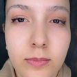 کلینیک زیبایی آذین کاشت