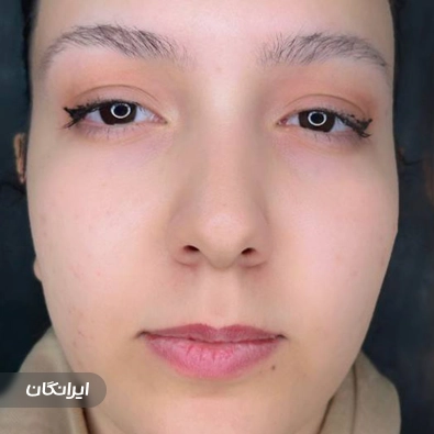 کلینیک زیبایی آذین کاشت