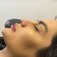 کلینیک زیبایی آذین کاشت