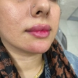 کلینیک زیبایی پارسیما
