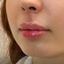 کلینیک زیبایی دکتر محمدرضا خوش آبی