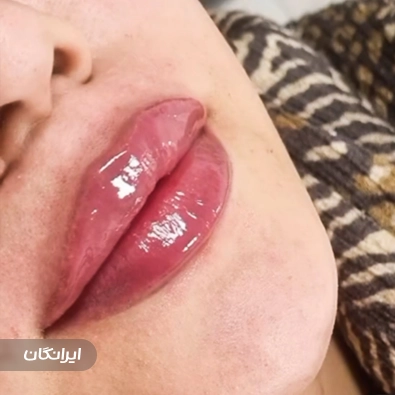 کلینیک زیبایی دکتر قربانی