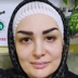 کارشناس کاشت مو میرم شیرزادگان