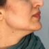 کلینیک زیبایی مه تیام