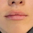 کلینیک زیبایی نسا
