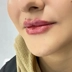 کلینیک زیبایی حبیبی