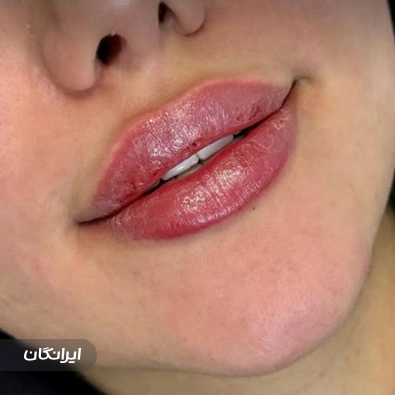 کلینیک زیبایی پاریز