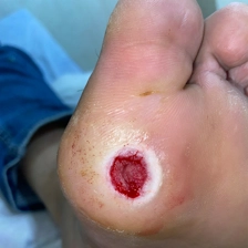 درمانگر زخم امیرمهدی نعمتی