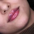 کلینیک زیبایی دکتر اعظم خانزاده