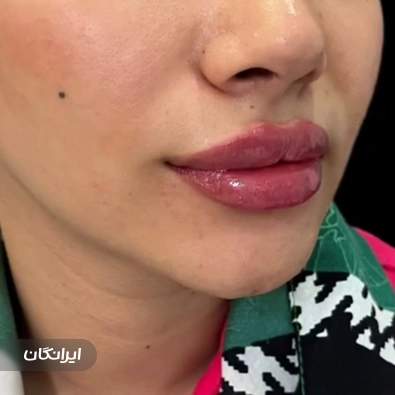 کلینیک زیبایی دکتر المیرا حسینی
