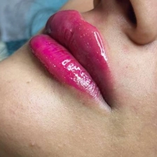 کلینیک زیبایی گلبرگ