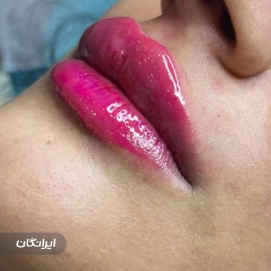 کلینیک زیبایی گلبرگ