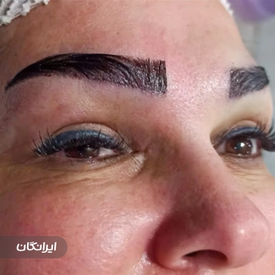کلینیک زیبایی آرام