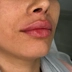 کلینیک زیبایی دکتر غزل حسن پور