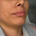 کلینیک زیبایی دکتر غزل حسن پور