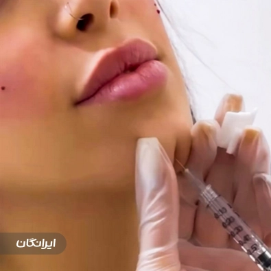 کلینیک زیبایی آیسو