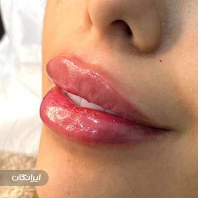 کلینیک زیبایی پناهی