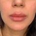 کلینیک زیبایی بلزا
