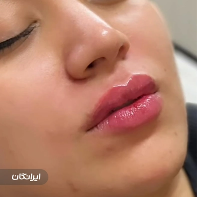 کلینیک زیبایی سون بیوتی
