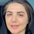 کلینیک زیبایی افرا