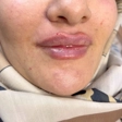 کلینیک زیبایی هرمس