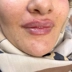 کلینیک زیبایی هرمس