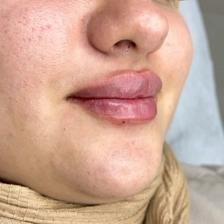 کلینیک زیبایی هرمس