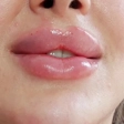 مطب زیبایی دکتر حیدری